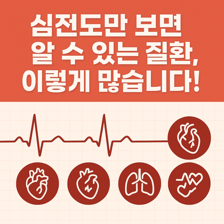  심전도(ECG)로 알 수 있는 질환｜심장이 보내는 SOS 신호 읽는 법