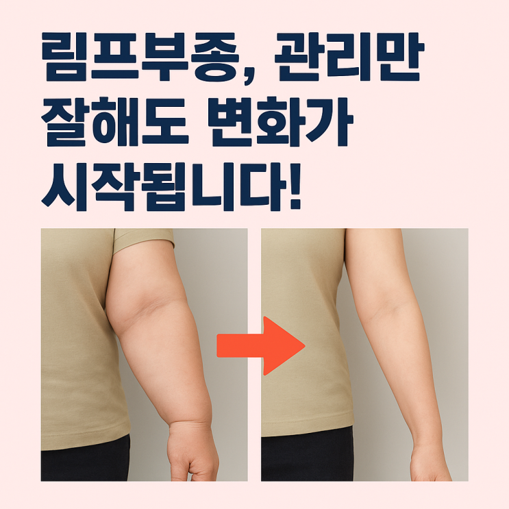  림프부종, 왜 생기고 어떻게 관리해야 할까?