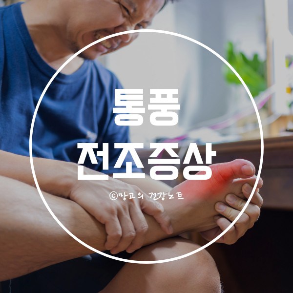 통풍 전조증상 초기증상 알아봅시다!