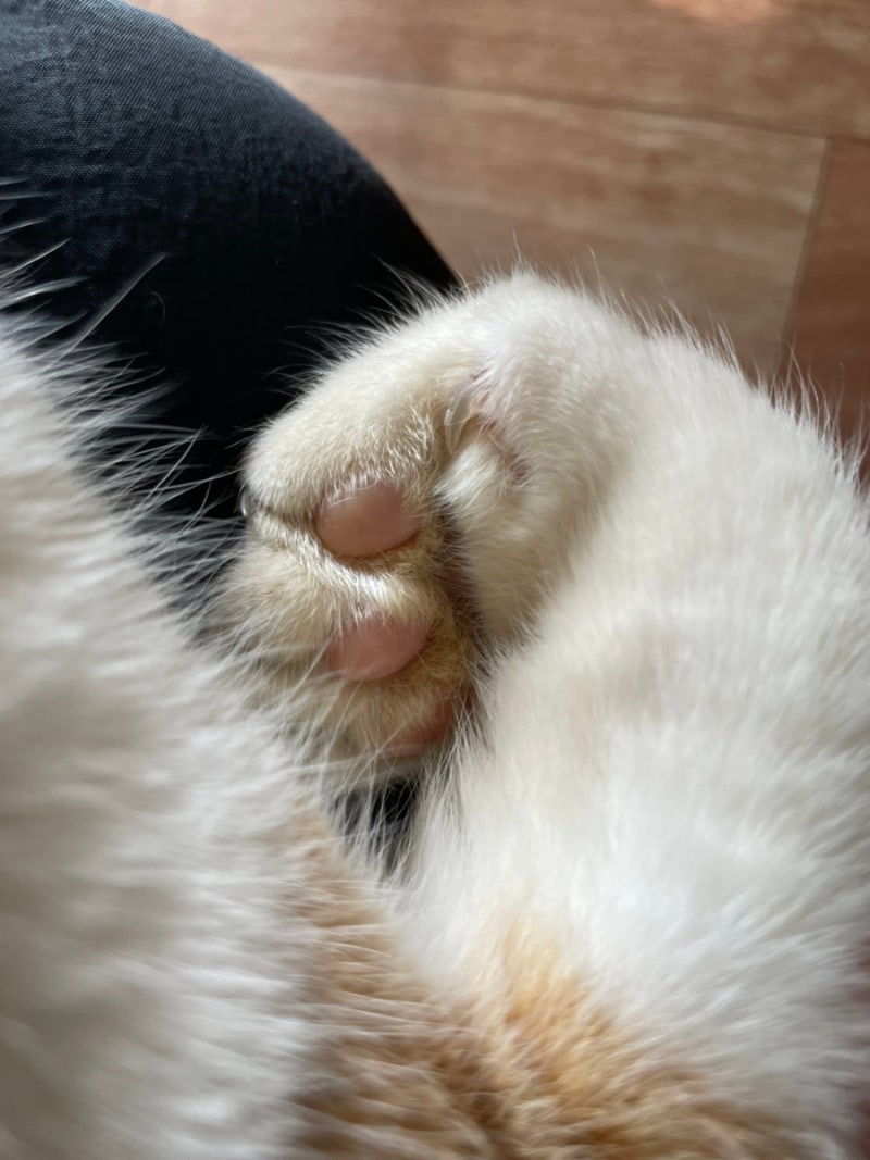 레푸스 굳은살 제거 후기 (사진,비용)