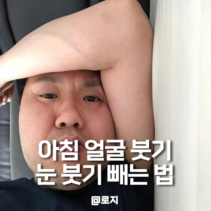  얼굴 눈 붓기 빨리 빼는 방법
