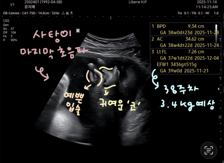  수원 리베르 여성병원 | 38주차 정기검진 및 제왕절개 예약