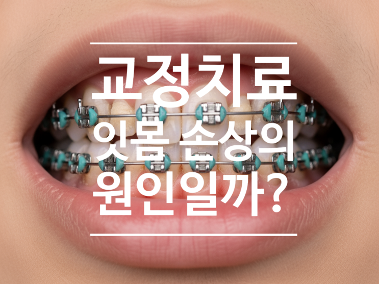  "교정하면 잇몸 나빠진다던데요?" 하남 교정 전문의가 알려드릴게요.