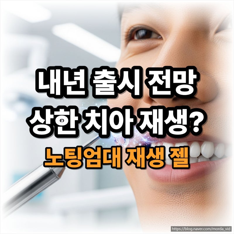 내년 출시 전망 바르는 치약으로 상한 치아 재생? 노팅엄대 법랑질 재생 젤의 모든 것
