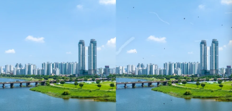  비문증 원인 치료 증상 눈앞에 벌레가 떠다녀요