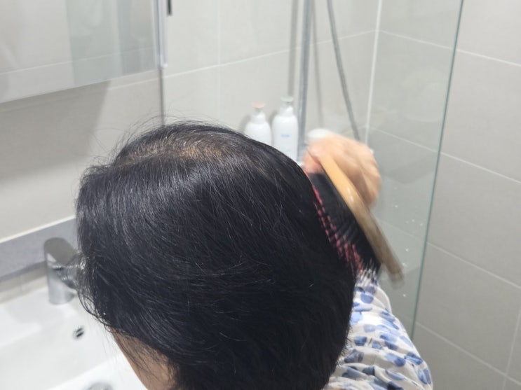  비오틴 추천 탈모 초기 요즘 머리카락이 많이 빠진다면