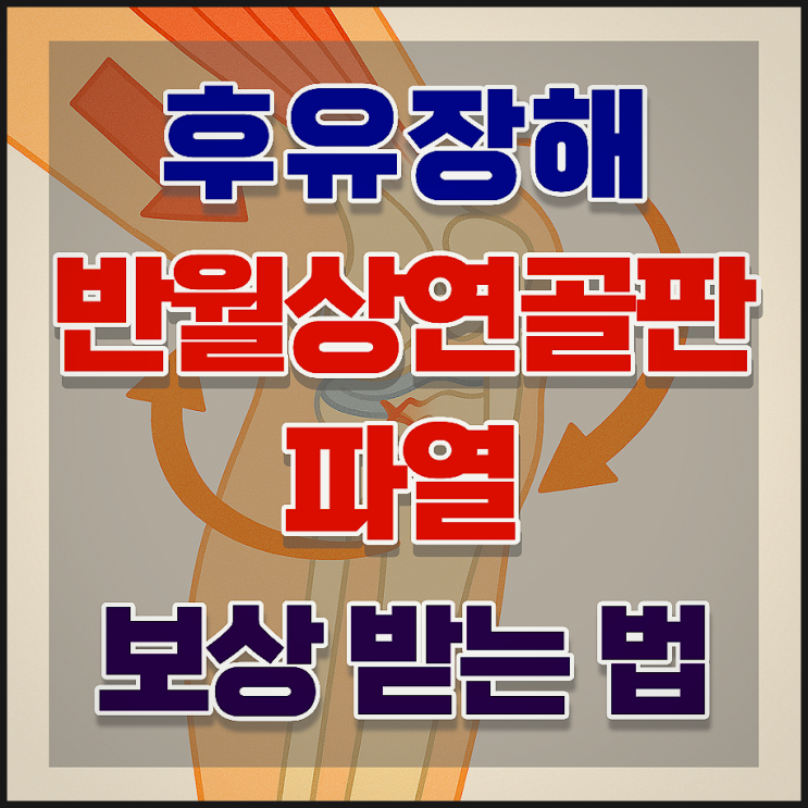  무릎연골 반월상연골파열 S83, 보험사는 무엇을 보고 보상할까?