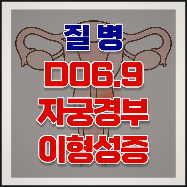  N87.1 자궁경부이형성증(CIN2) 진단 후 보험금 받으려면 반드시 필요한 것