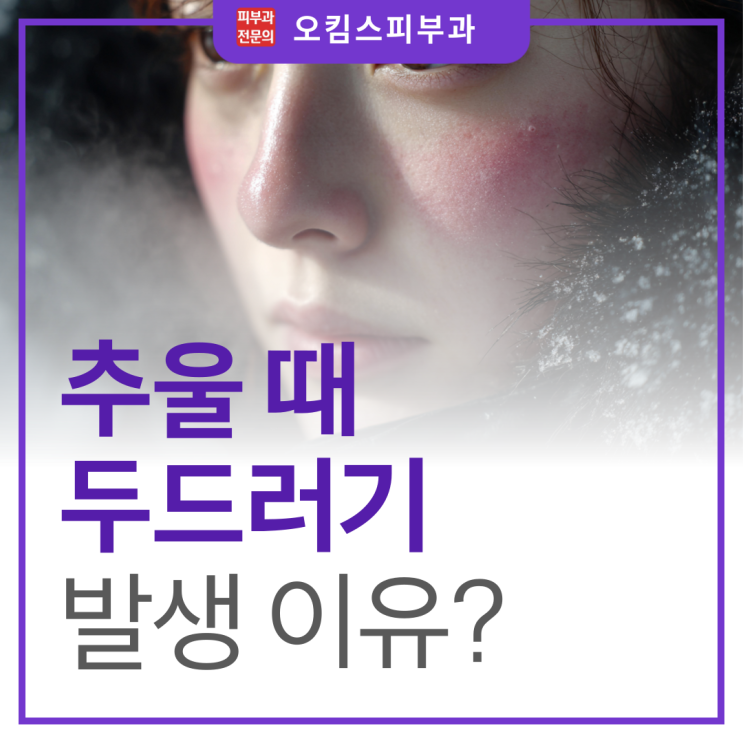  일산 백석동 피부과 추울때 두드러기, 한랭성 알러지 증상일까?
