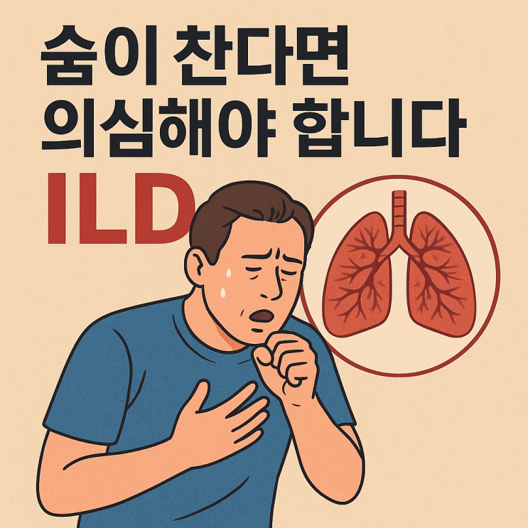  폐 섬유화(ILD) 이해하기 – 증상부터 관리까지 한눈에 정리