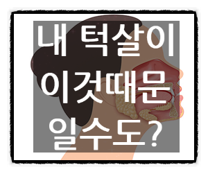 침샘 비대증 치료, 침샘 비대증? 얼굴형 바꾸는 필살기!