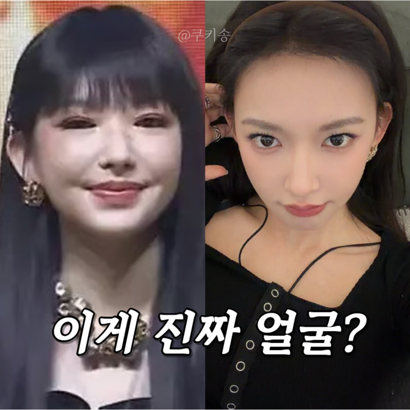 우주소녀 성소 근황, 성형 부작용 논란! 붓기 빠지고 인스타 복귀?