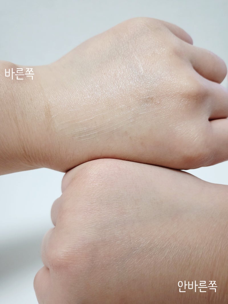 이자녹스 데이티놀 크림, 레티놀크림 정석 피지개선 해결