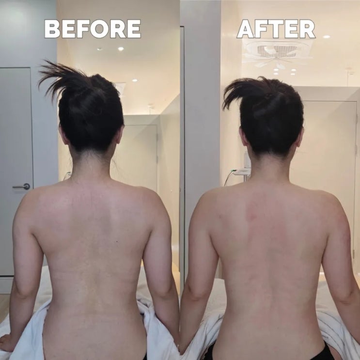  부산 동래에스테틱 다이어트 웨딩 슬리밍관리 잘하는 울림에스테틱