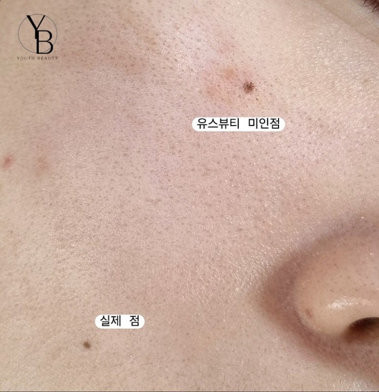  광주 미인점 추천 유스뷰티 탁월한 선택