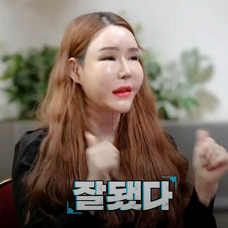  “물어보살 1억4천 성형… 서장훈 한마디에 무너졌다”