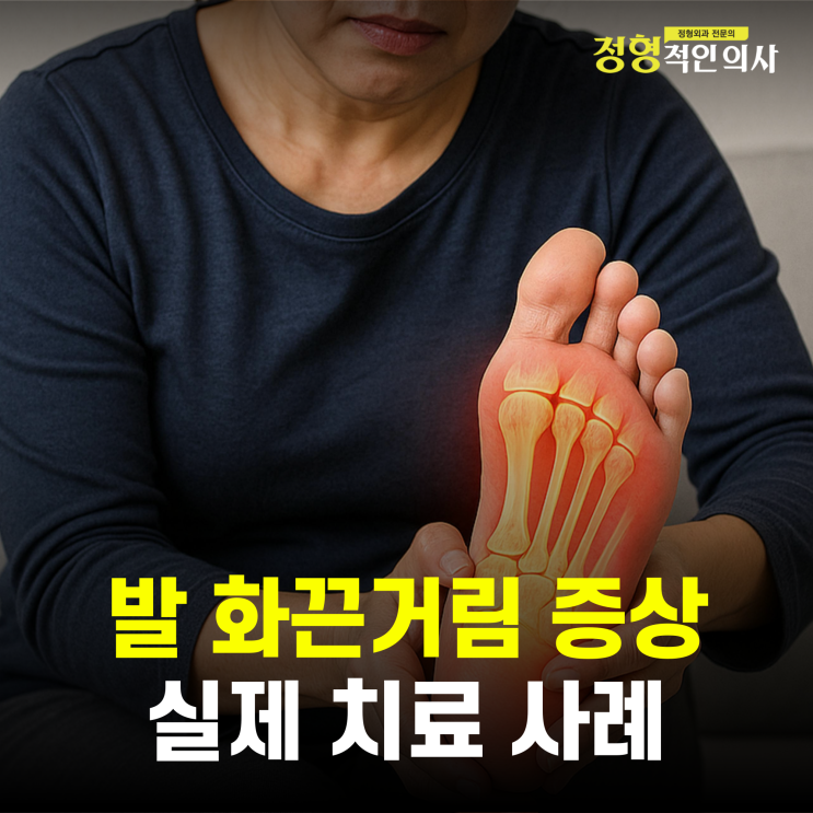  "발바닥이 불에 데인 것처럼 아파요” — 말초신경병증 환자 치료 이야기(의사작성)