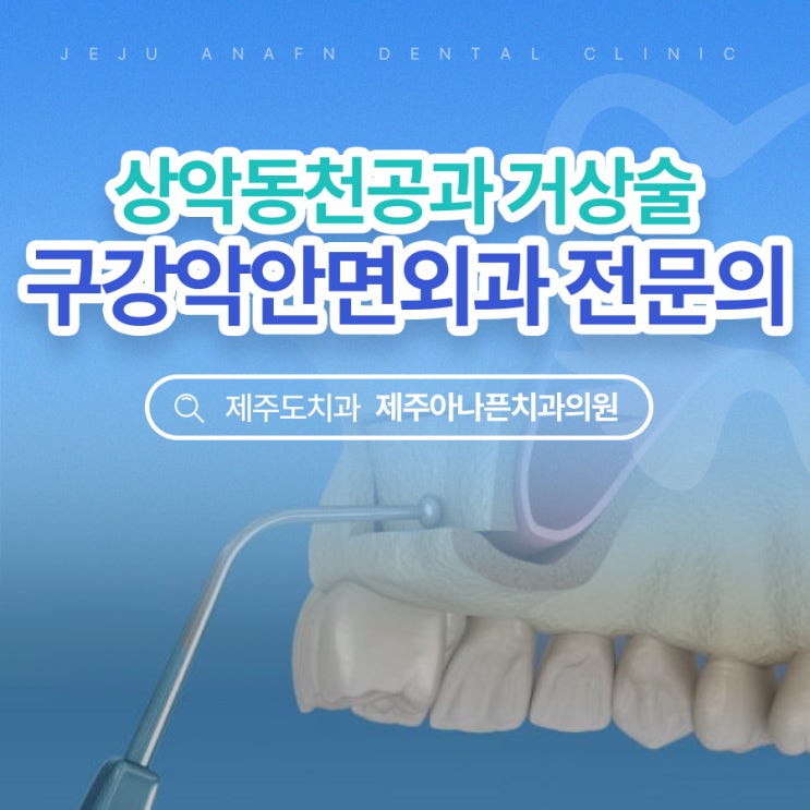  제주임플란트 윗니 천공 상악동거상술 알고 받으셔야죠