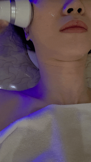  인천 논현동 피부관리 에스테틱 홍조 속건조 잔주름까지 한번에 잡는 재생에너지케어 엑소플라즈마 후기 더맑은스킨 주차가능