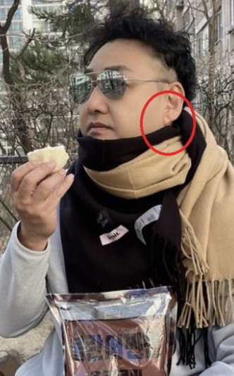   쓰러진 김수용, 귓볼 주름이 전조증상? ‘프랭크 징후’ 논란 핵심