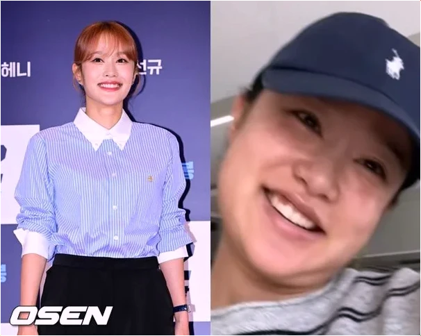  헤이지니 산후 리프팅 관리 근황! 시술 후 심한 부기까지 솔직 고백