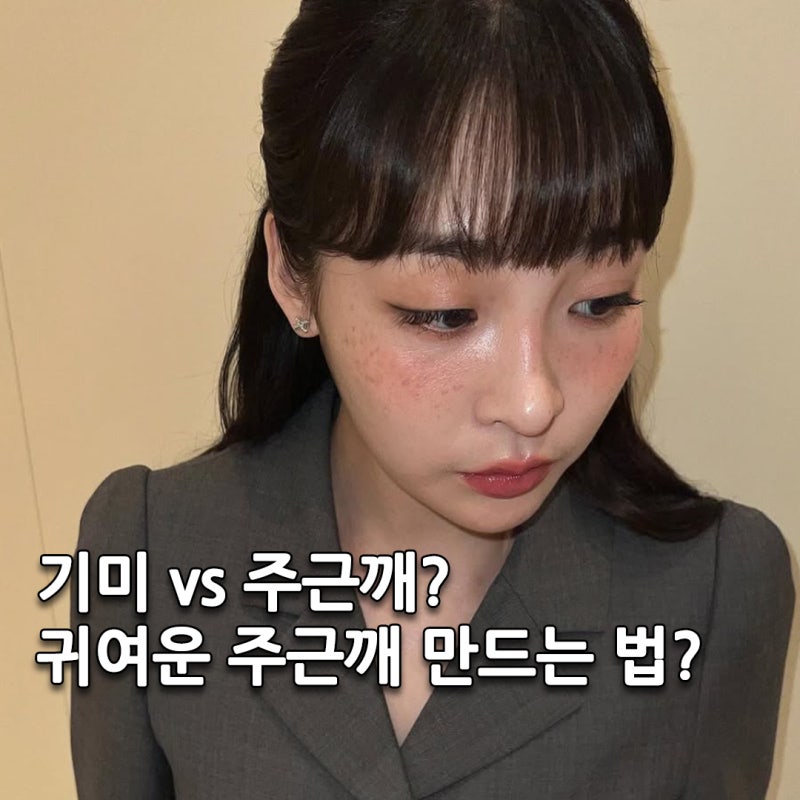김민하 주근깨 vs 기미 차이점은 뭐야?