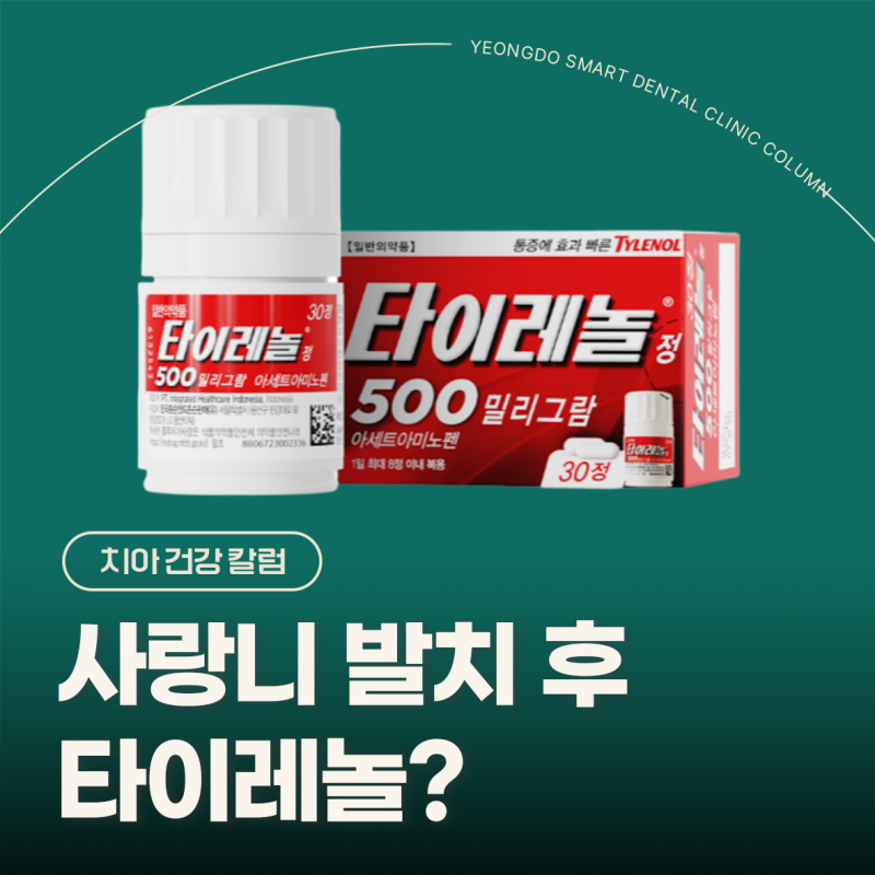 사랑니 발치 후 진통제 타이레놀?
