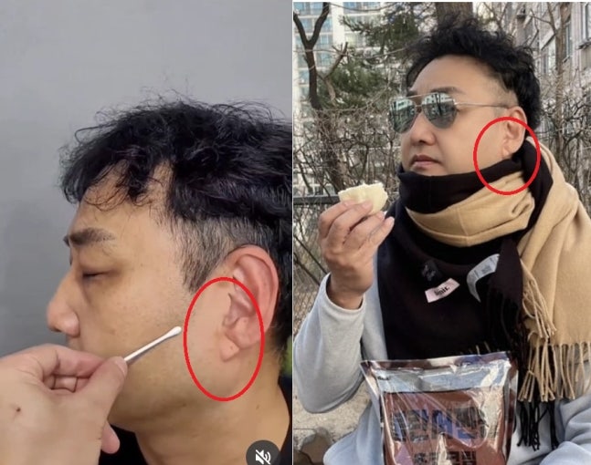 <b>김수용</b>, 촬영 중 급성 심근경색으로 쓰러져...현재는 <b>회복</b> 중
