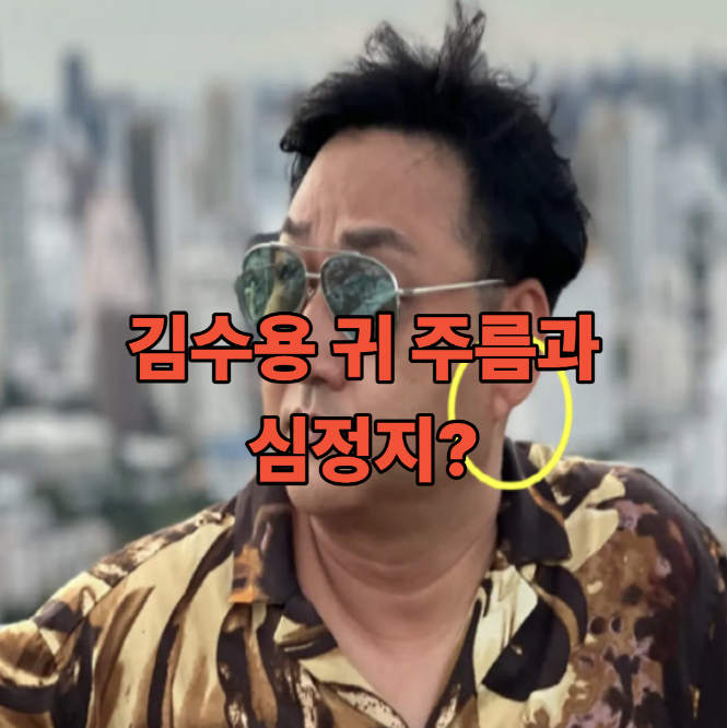  김수용 귀 주름과 심정지? 프랭크 징후가 의미하는 건강 신호