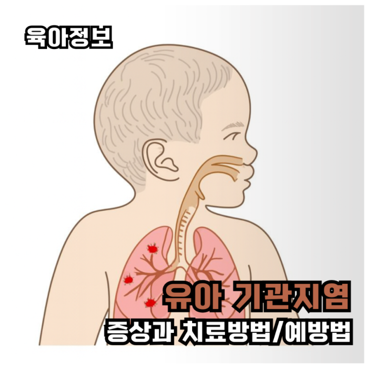  [아기 기관지염]증상·원인·대처법 총정리
