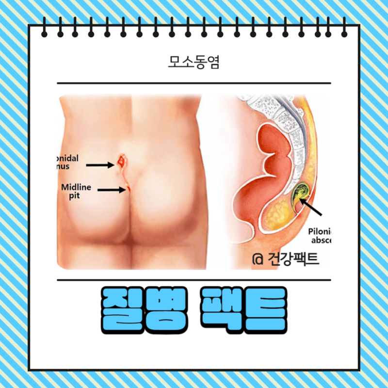 ERCP 시술 적응증 부작용, 검사 전 반드시 확인하세요!