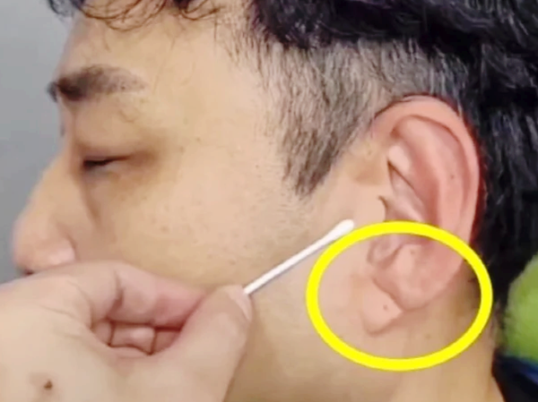 <b>김수용</b> 쓰러지기 전 <b>귓불</b>에 ‘사선 <b>주름</b>’ 있었다? 프랭크 징후... 