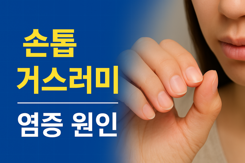 손톱 거스러미 염증 원인, 왜 더 아프게 느껴질까?