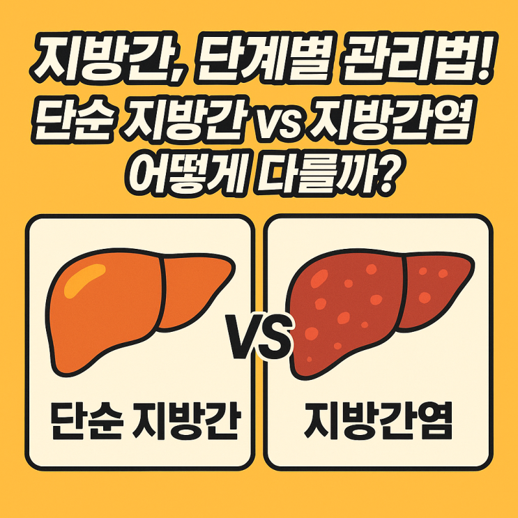  지방간, 단계별 관리법 총정리! 단순 지방간 vs 지방간염