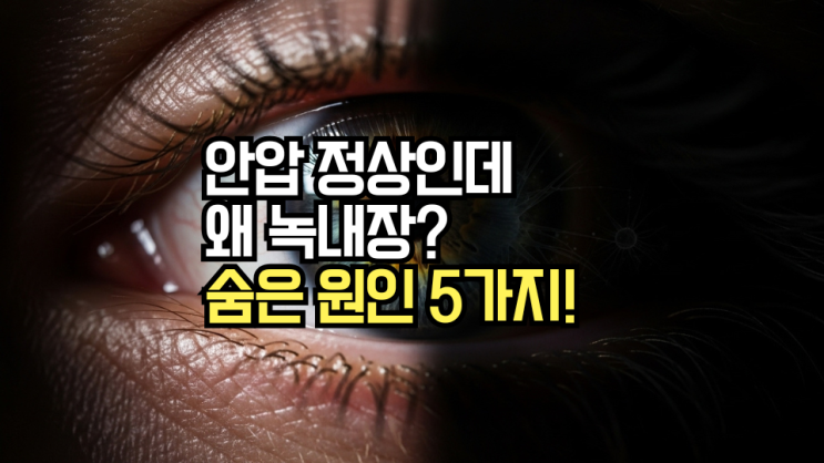  녹내장 발생 위험 요인과 진단: 소리 없는 실명 질환의 초기 증상 놓치지 않는 법