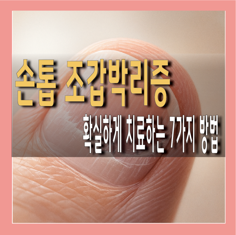 손톱 조갑박리증, 원인부터 치료 방법 7가지