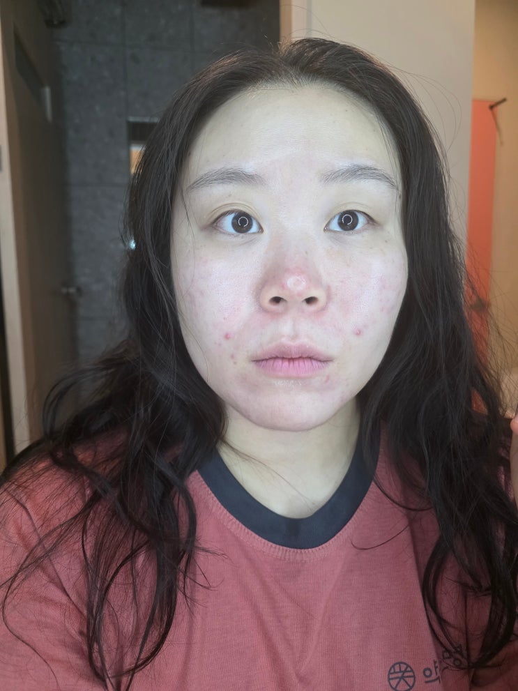  서초피부관리 반포약손명가 이중턱 관리 후기