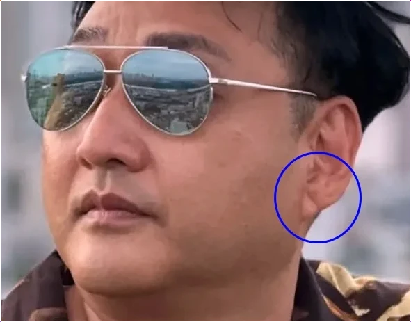 김수용 심근경색 징조! 귓불 사선 주름 프랭크 징후 위험 신호