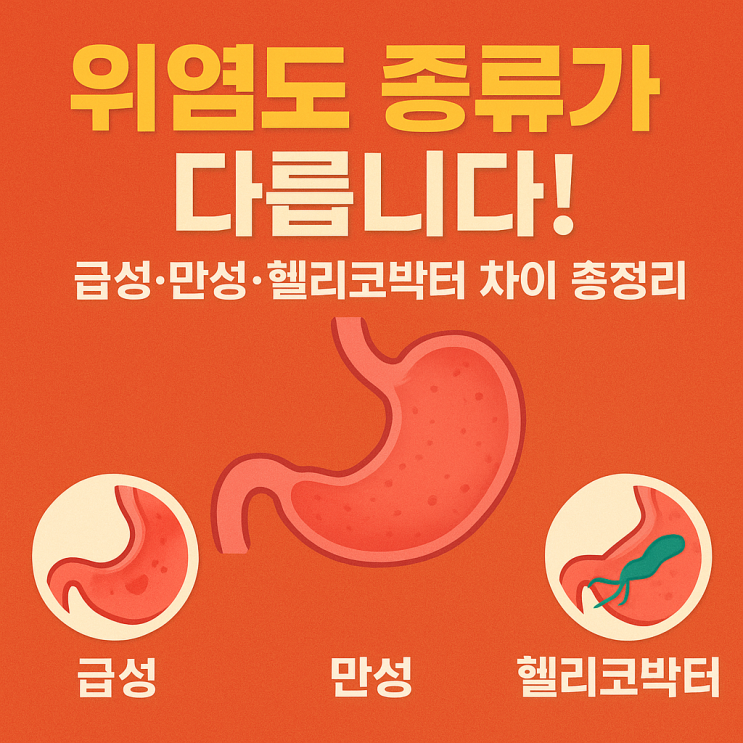  위염 종류별 증상 정리(급성·만성·헬리코박터) 한눈에 이해하기