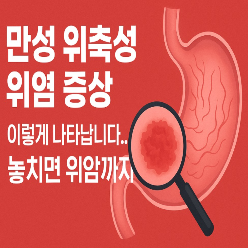만성 위축성 위염 증상, 이렇게 나타납니다… 놓치면 위암까지?
