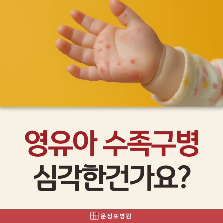  파주 운정 아이 입원 영유아 수족구병 원인 증상, 격리 기간은?