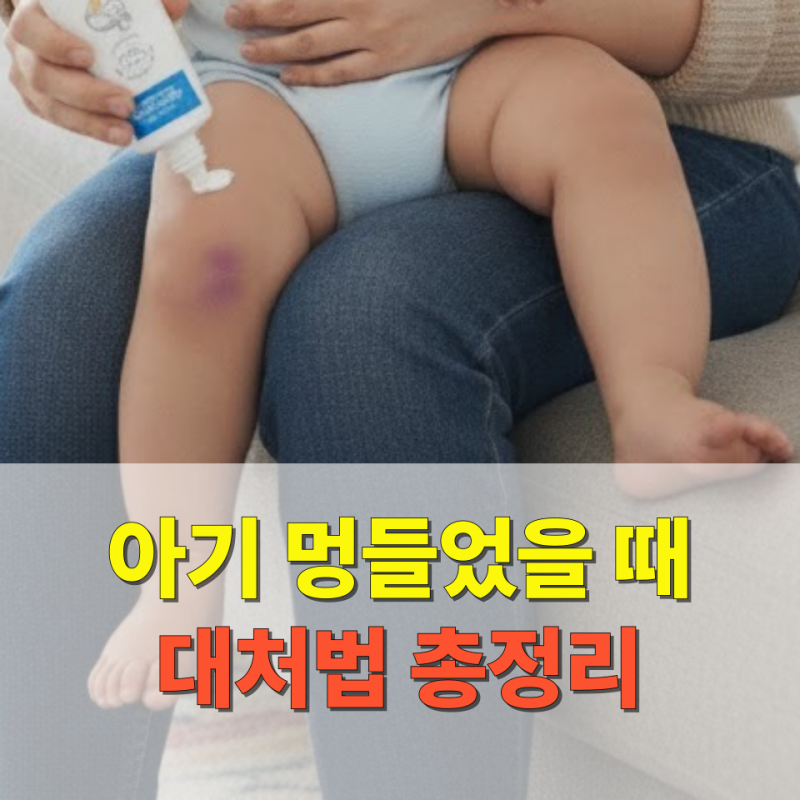아기멍들었을때 멍크림 연고 비판텐 발라도 괜찮을까?