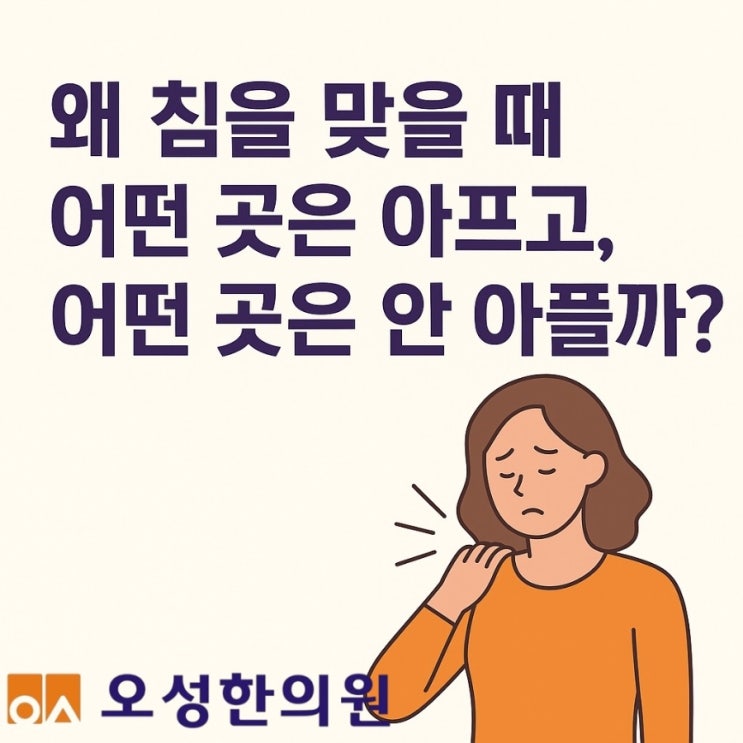  왜 침을 맞을 때 어떤 곳은 아프고, 어떤 곳은 안 아플까? 봉일천 오성 한의원