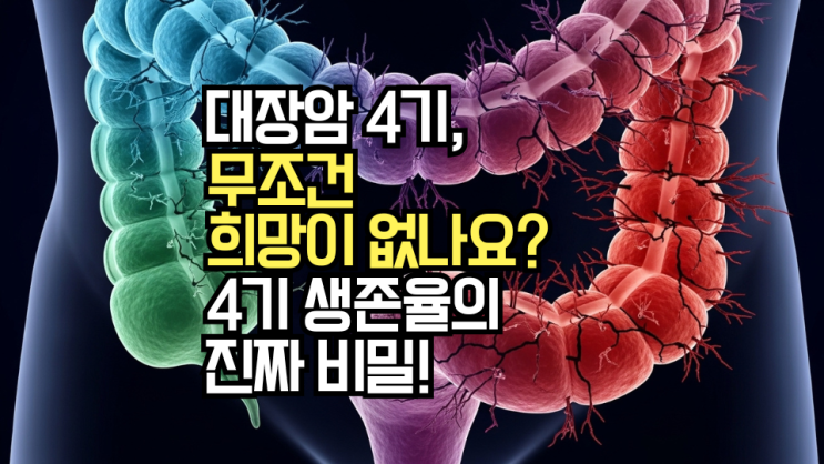  대장암 병기, 침범 깊이와 전이 여부가 핵심! 0기부터 4기까지 관리법 차이 총정리