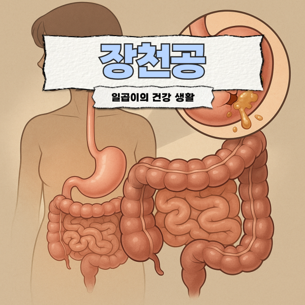 장천공 증상 원인 치료방법으로 극복 사례