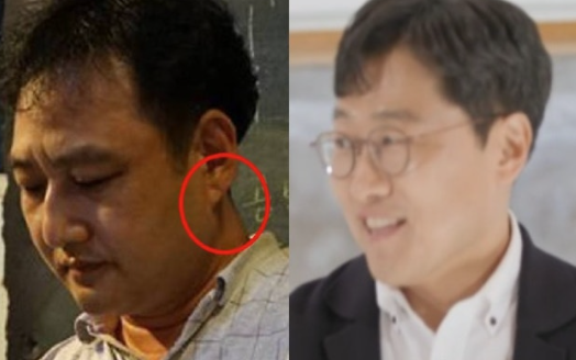   ‘귓불 주름’ 논란 이어…김상욱 교수까지 심근경색 전조 증상?! 너무 평범해서 더 무섭다