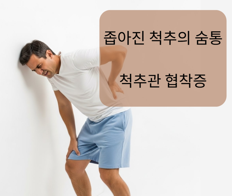  좁아진 척추의 숨통을 틔우다 — 걷기 힘든 당신의 '척추관 협착증'
