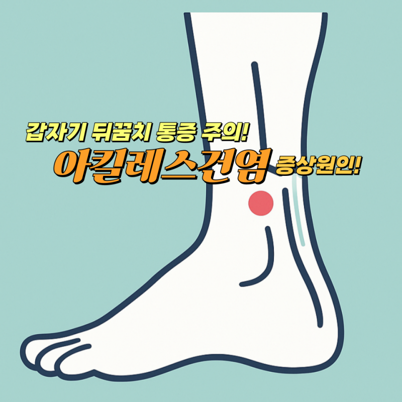 아킬레스건염 증상과 원인, 아킬레스건 통증이 시작되는 이유