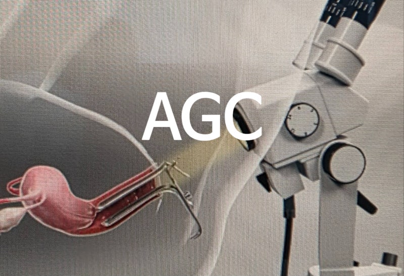 : 25세 여성에서 발견된 AGC(비정형선세포) 자궁경부세포검사 결과와 필수 추적 평가