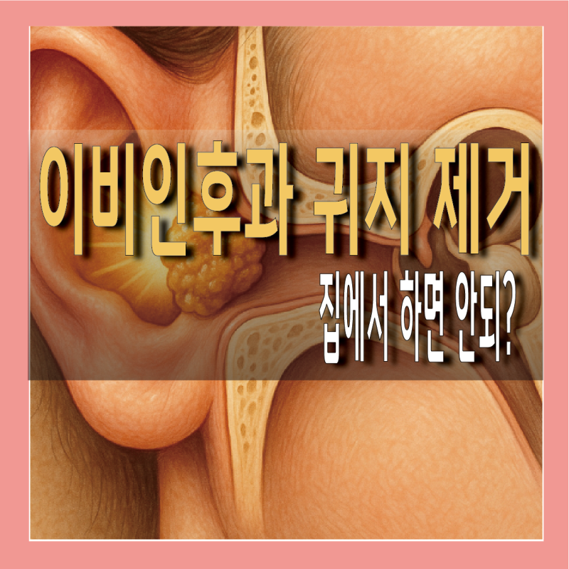 이비인후과 귀지 제거 비용 / 귀청소 병원 가야 할까?